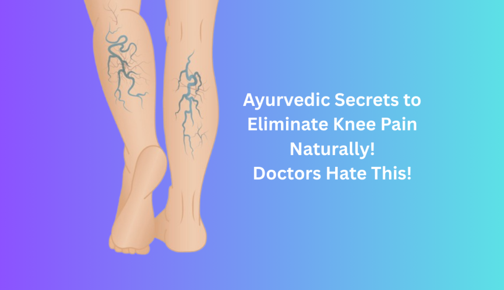 Varicose Veins Treatment in Ayurveda