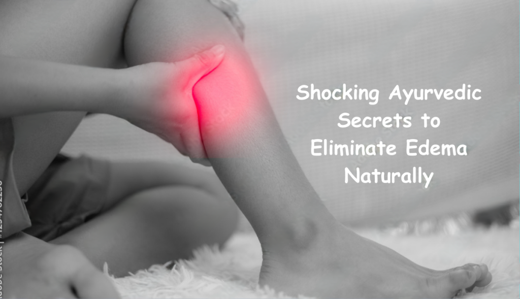 Ayurvedic Treatment for Edema