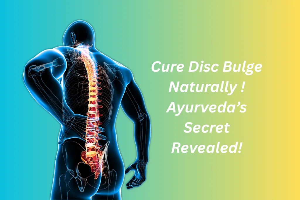 Ayurvedic Treatment for Disc Bulge