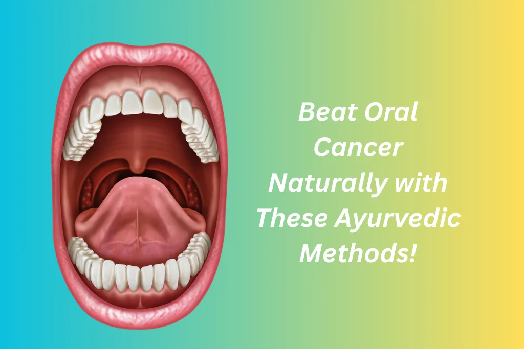 Ayurvedic Treatment for Oral Cancer