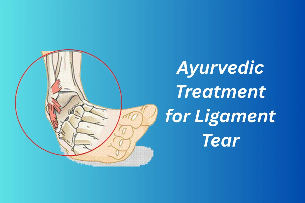 Ayurvedic Treatment for Ligament Tear