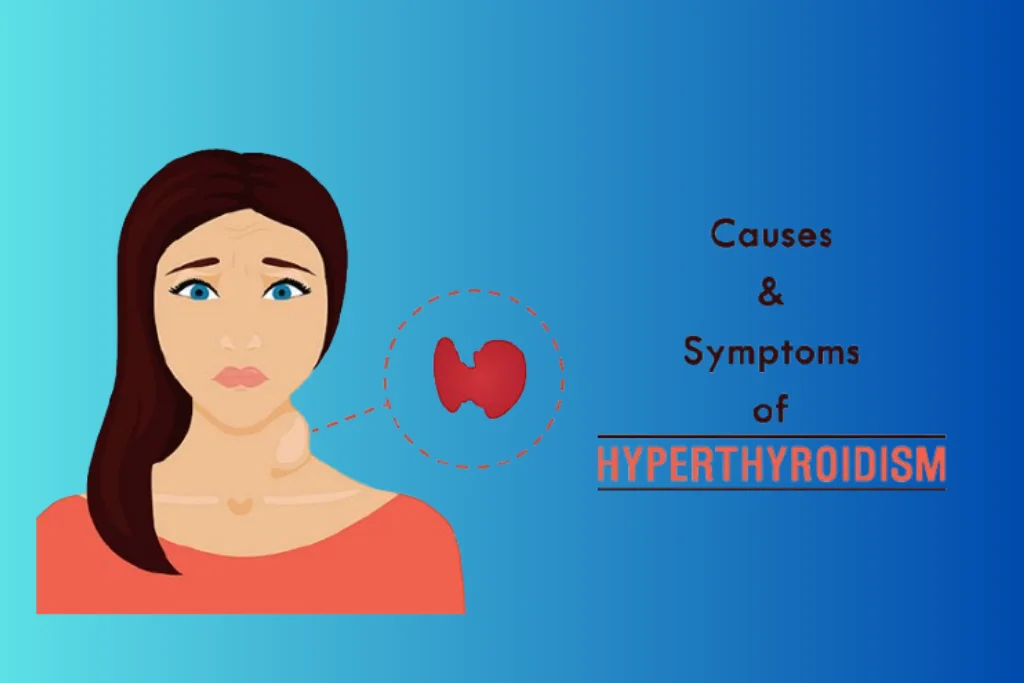 Ayurvedic Treatment for Hyperthyroidism